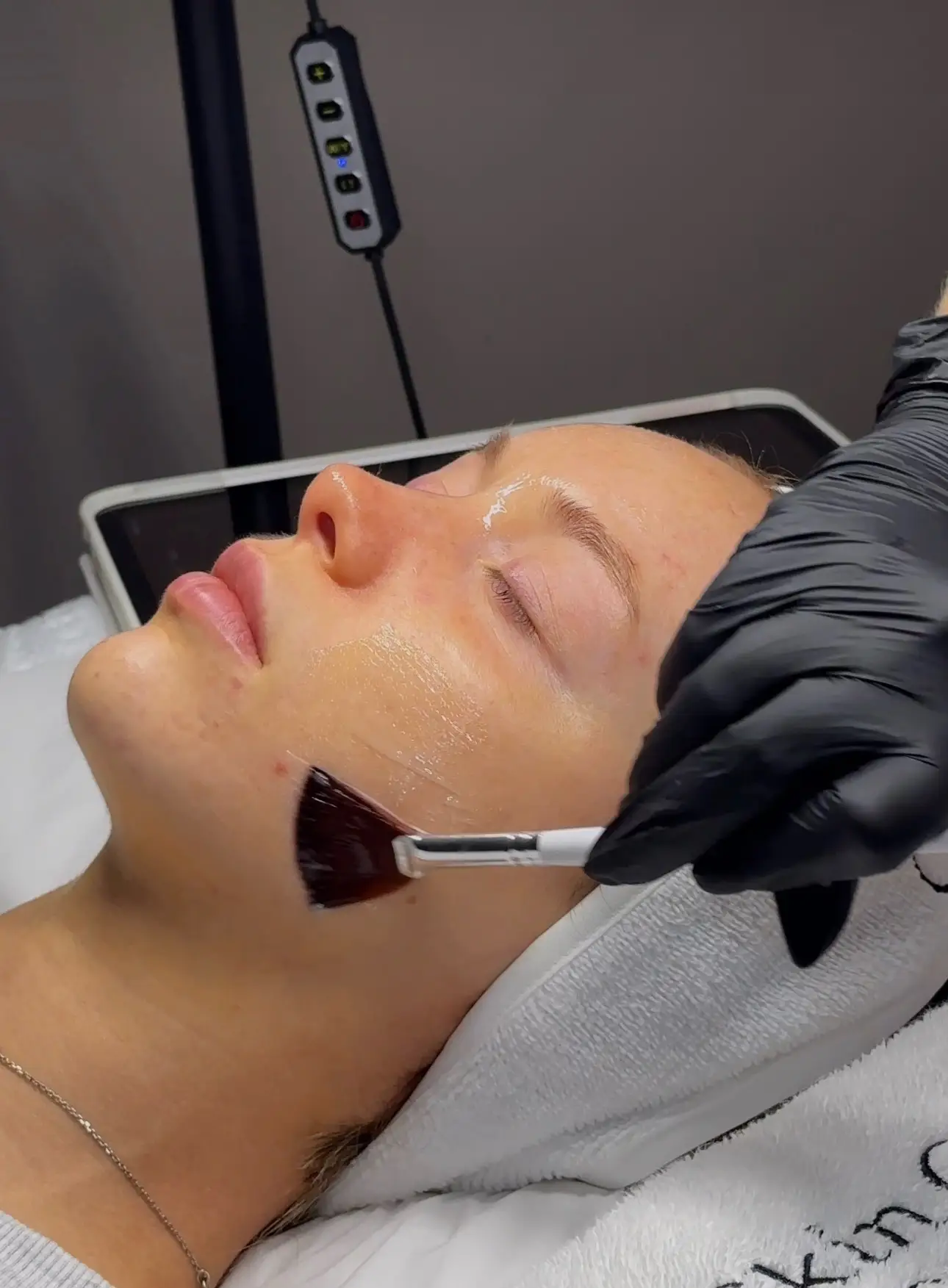 Chemical Peels advanced skin facial