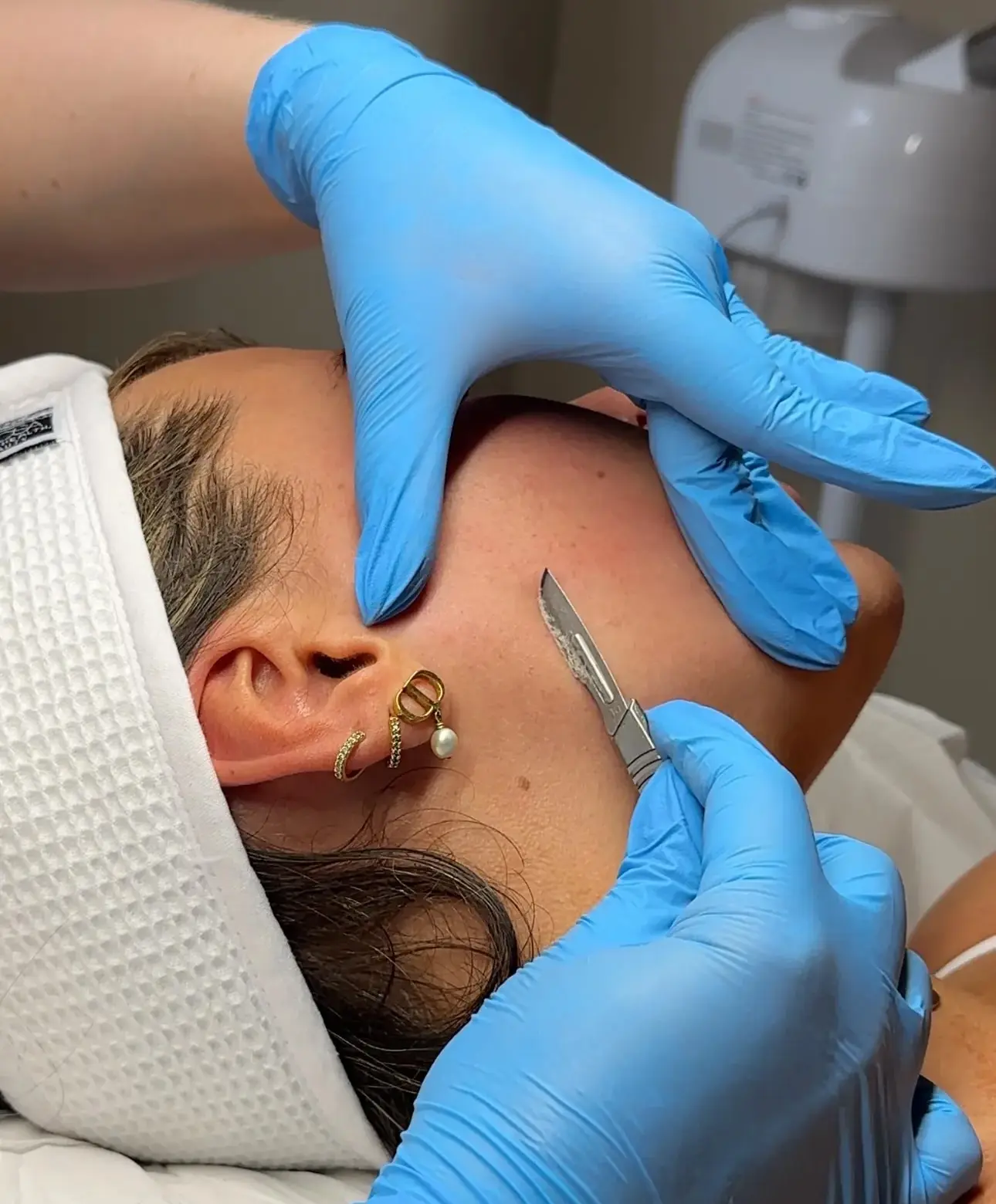 Dermaplaning Facial treatment session