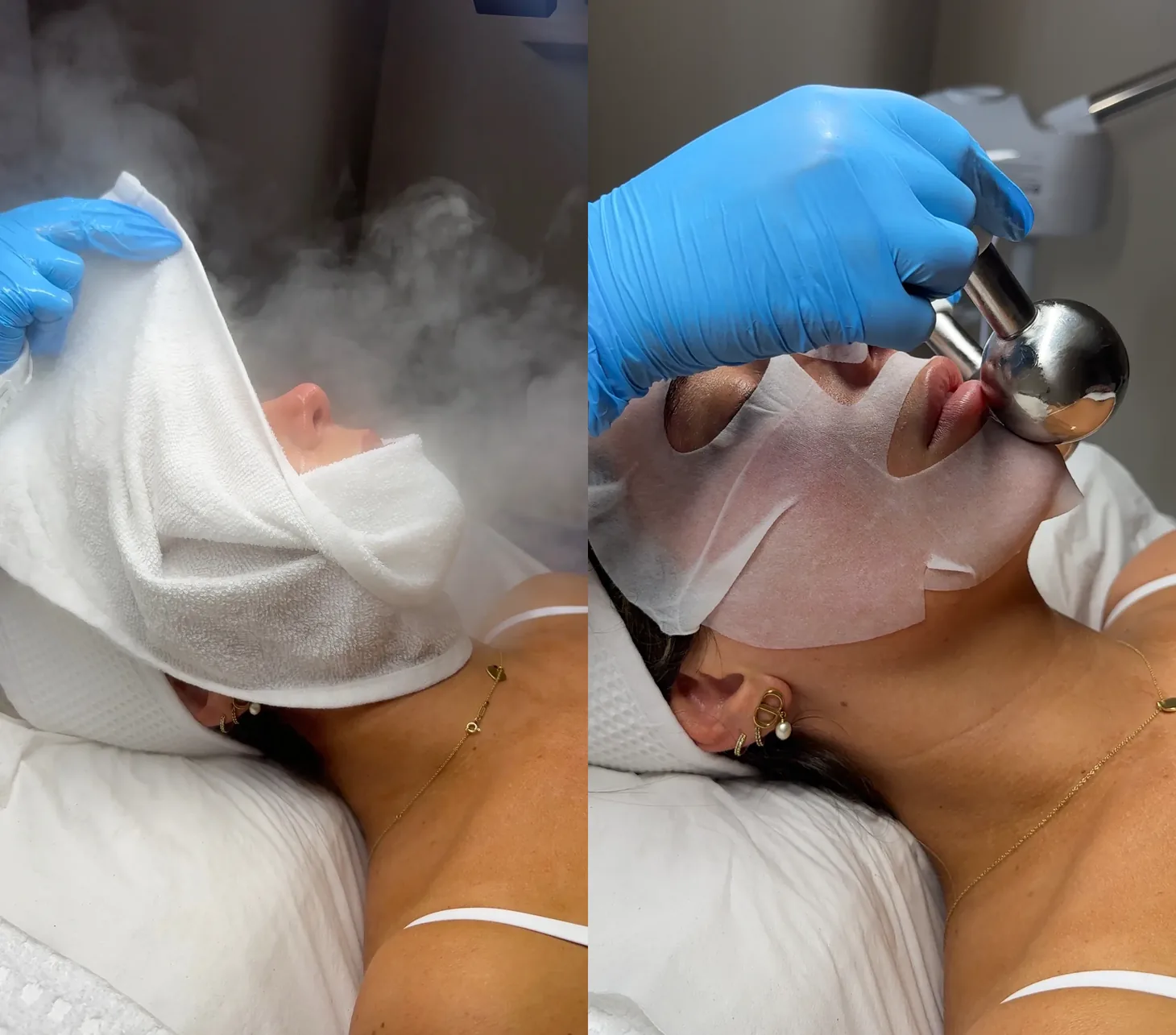 Steam facial and facial roller treatments at SKIN CARD Clinic